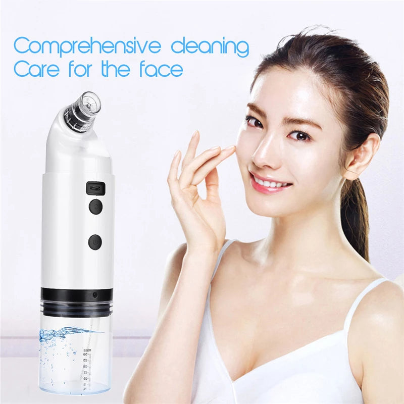 Electric Facial Blackhead Vacuum (Blackhead Remover Vacuum)