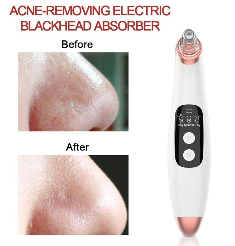 USB LED Blackhead Vacuum Remover (Blackhead Remover Vacuum)