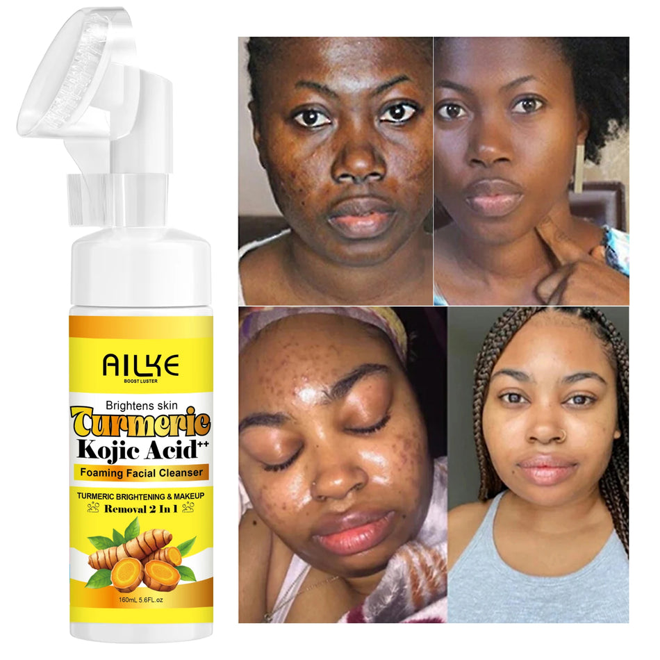 Brightening Turmeric Foam (Foam Acne Cleanser)