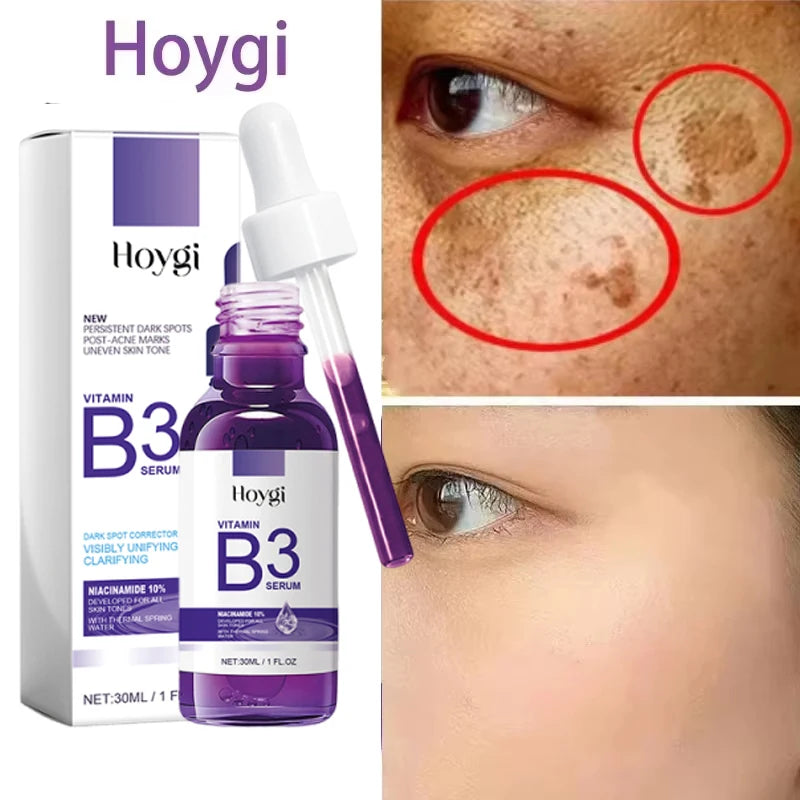Hoygi Niacinamide Brightening Serum (Retinol Serum)