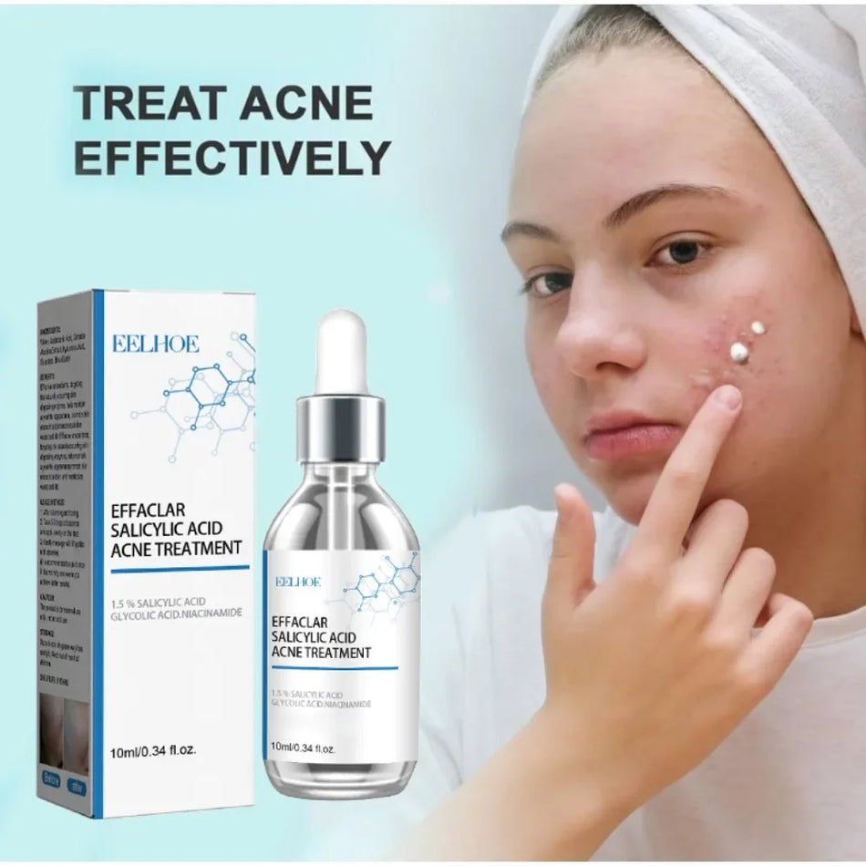 Fruit Acid Acne Control Face Serum (Niacinamide Toner)