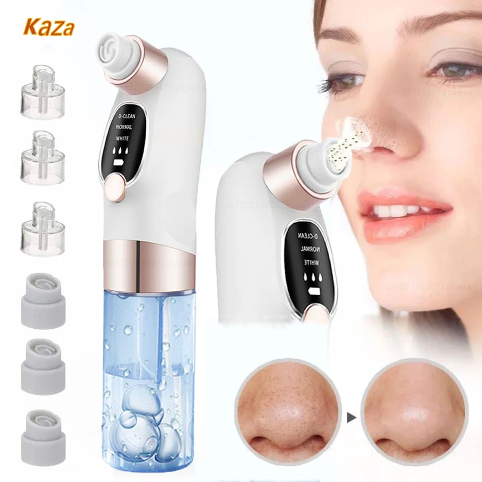 Pore Vacuum Cleaner (Foam Acne Cleanser)