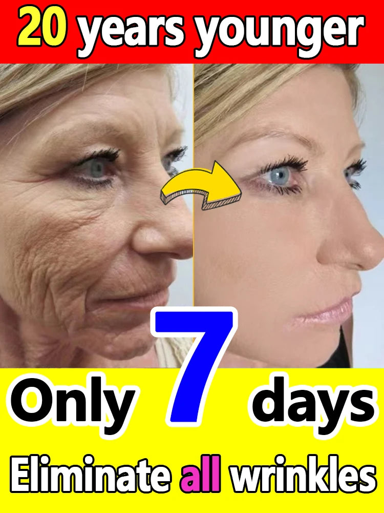 Age-Rewind Wrinkle Smoother (Retinol Serum)