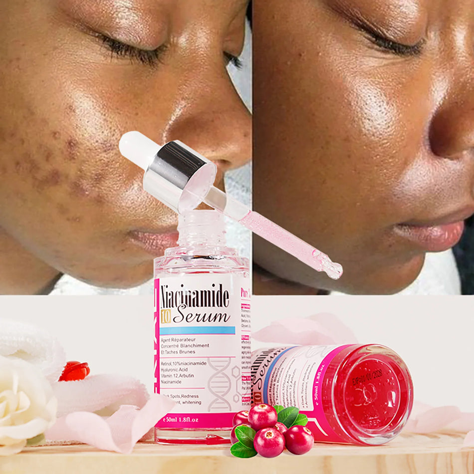 LKIAE Niacinamide Whitening Essence Serum (Niacinamide Toner)